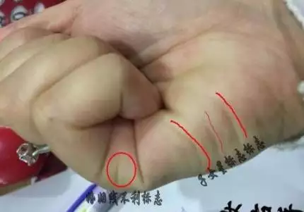 握拳看生几个孩子图解，子女宫图看生几个孩子