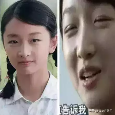 命太好的人眼睛要留疤，女人破相了会改命的