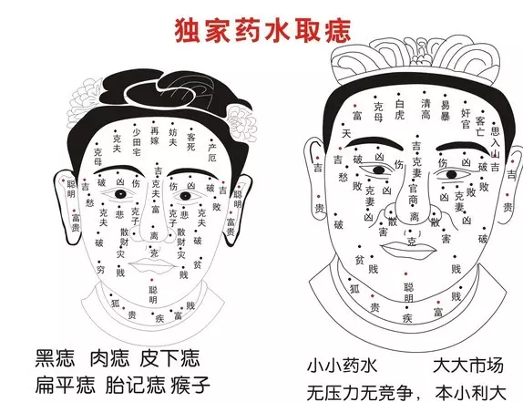 3、点掉脸上的痣改变运势:去掉痣后是不是改变了运势