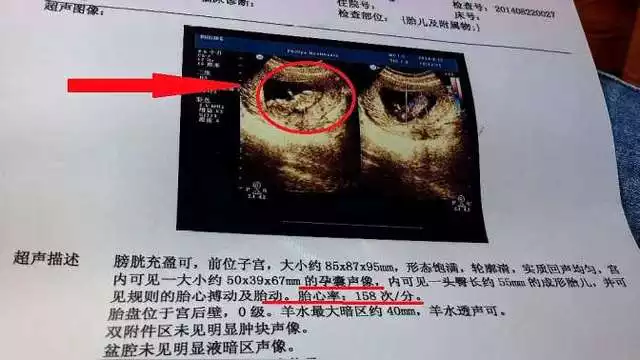 1、怀孕几个月能查出性别:nt如何看男女性别