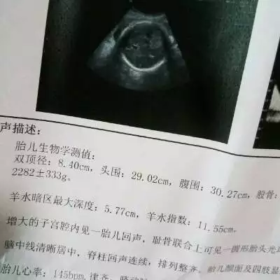 4、怎么算怀孕男孩女孩最准:生男生女怎么算准确啊