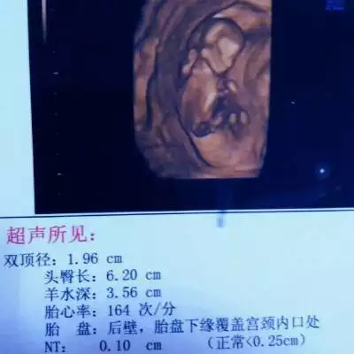 1、10秒测出怀男孩和女孩:超准!怀男孩和怀女孩的不同症状