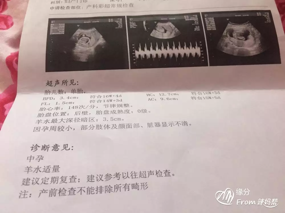 3、怀孕初期怎样测男女准确率:男女怎么看最准确的