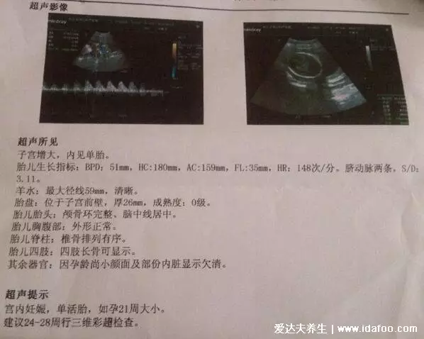 2、彩超单子上m和f在哪里:四维彩超图片右上方的m和f什么意思