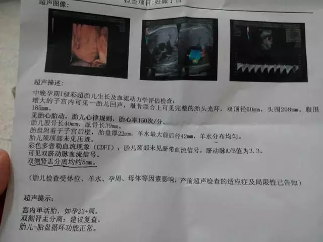 3、彩超单子上m和f在哪里:f和m分别代表男女怎么看的？