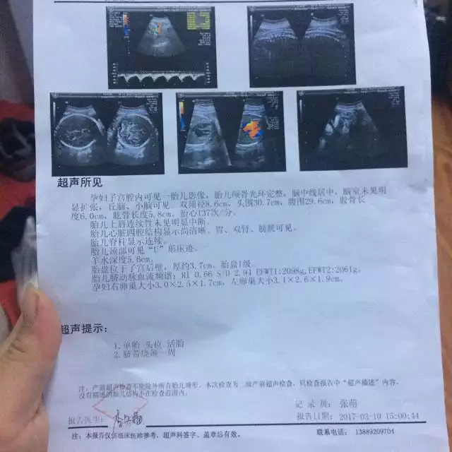 4、彩超单子上m和f在哪里:指针式万用表MF-47的M和F是什么意思或指的是什么