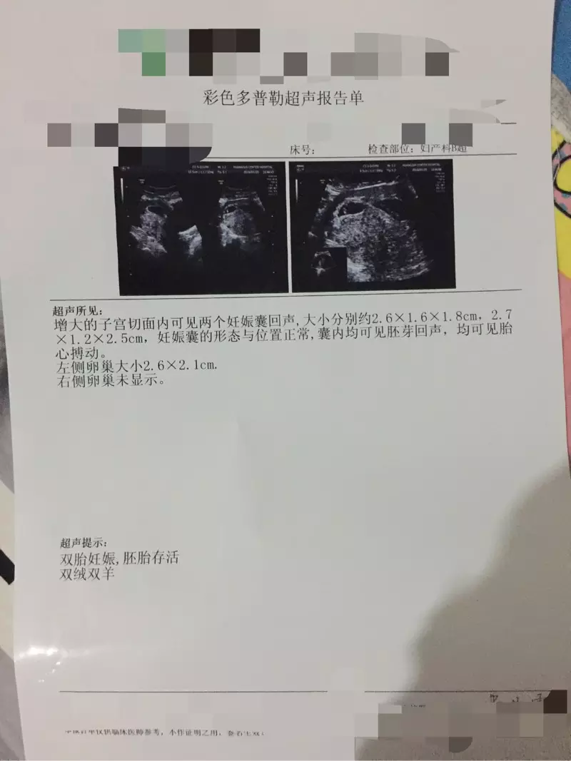 4、孕囊大小对照表50天:请问姐妹们,怀孕7周左右B超孕囊的长圆来看男女真的很准么?