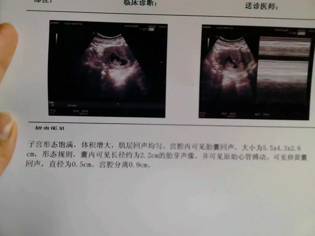 2、刚怀孕怎么测男女宝宝最准:测男女宝宝最准的方法