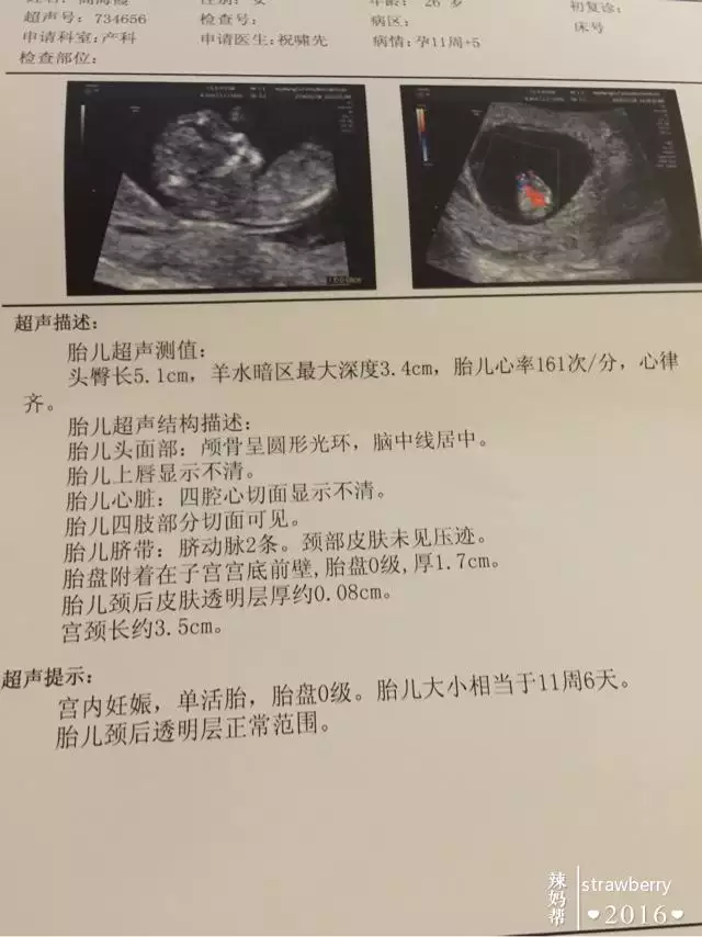 4、怀孕怎么看是男是女计算公式:如何算生男生女最准确