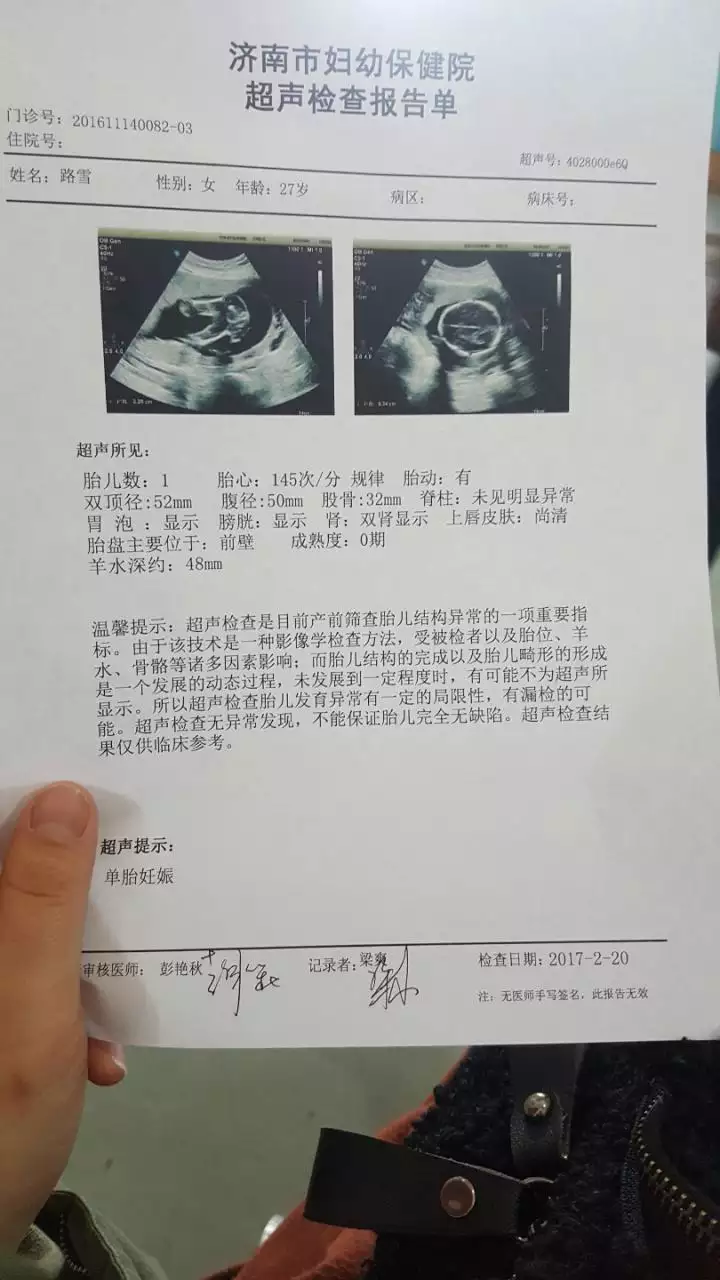 1、做的B超，我问医生查男孩女孩多少钱，她说男孩，女孩，你这是胎，我给你点，男