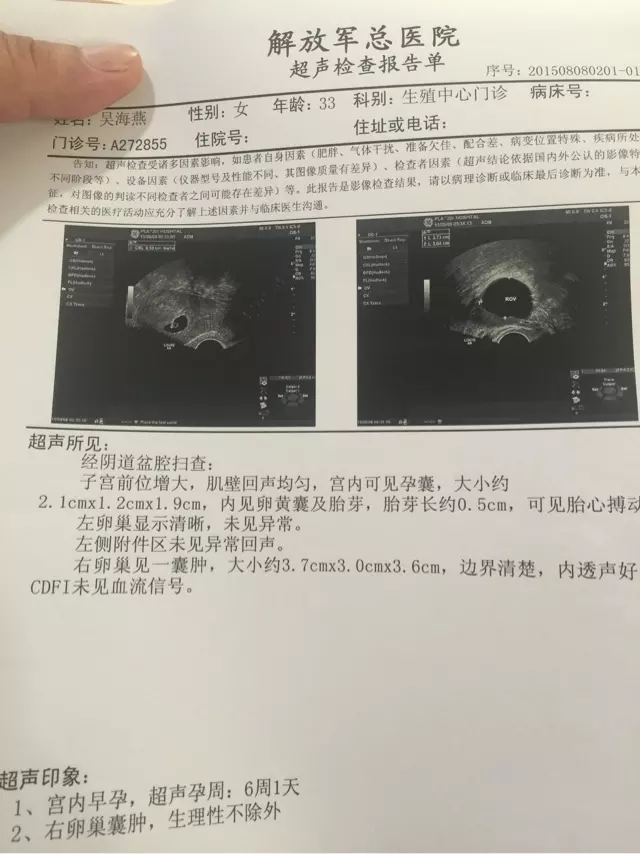 3、很多医生都会看B超单子，一看就知道男女，准确率百分之九十以上。