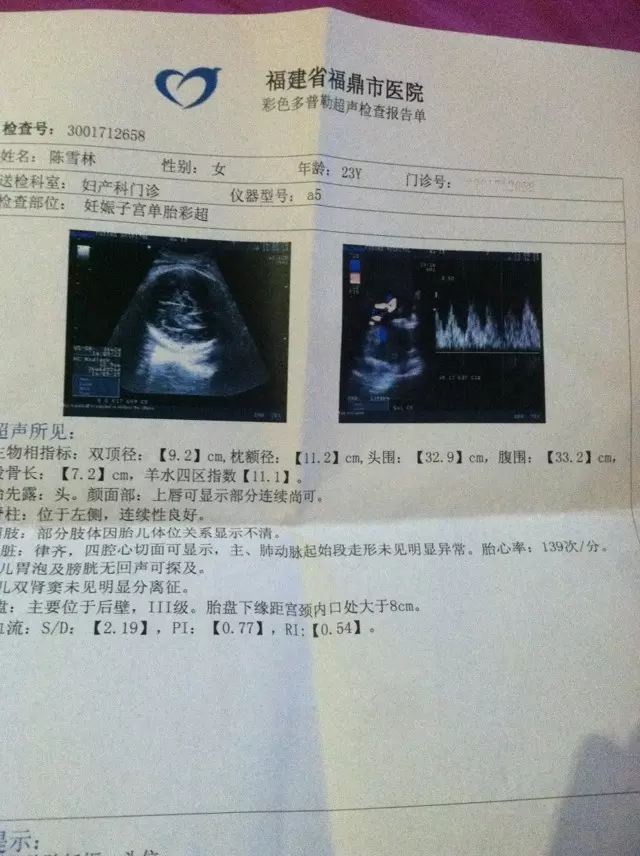 4、b超查男女只要元:请各位妈妈来验证一下,当初B超看男女准确吗?