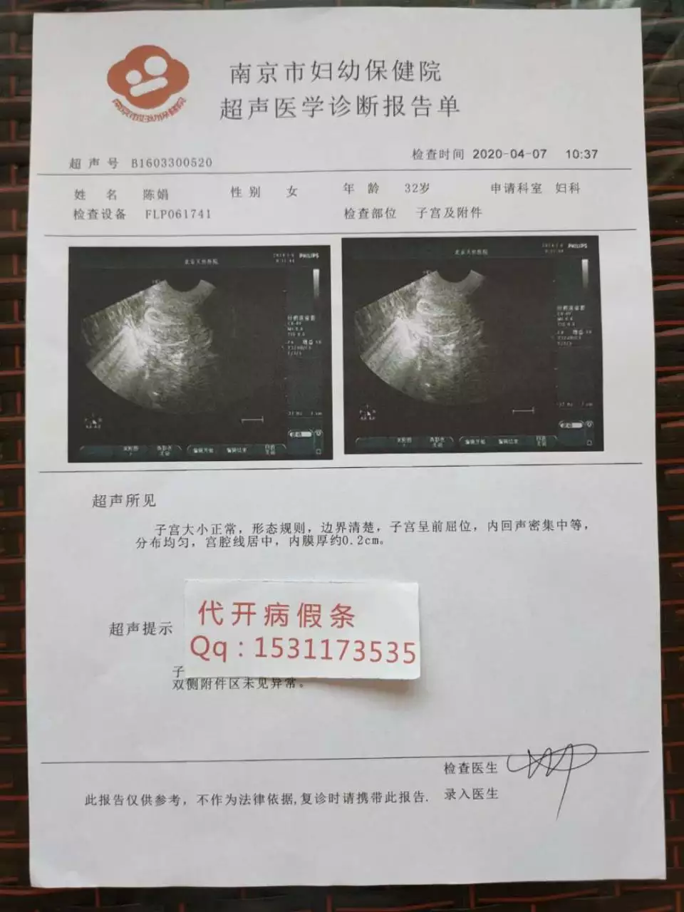 2、怀孕3一4天征兆:这样的牙膏测孕是不是怀孕了呢？