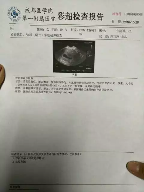 1、怀孕10几天能打掉吗:怀孕10几天左右能打掉吗