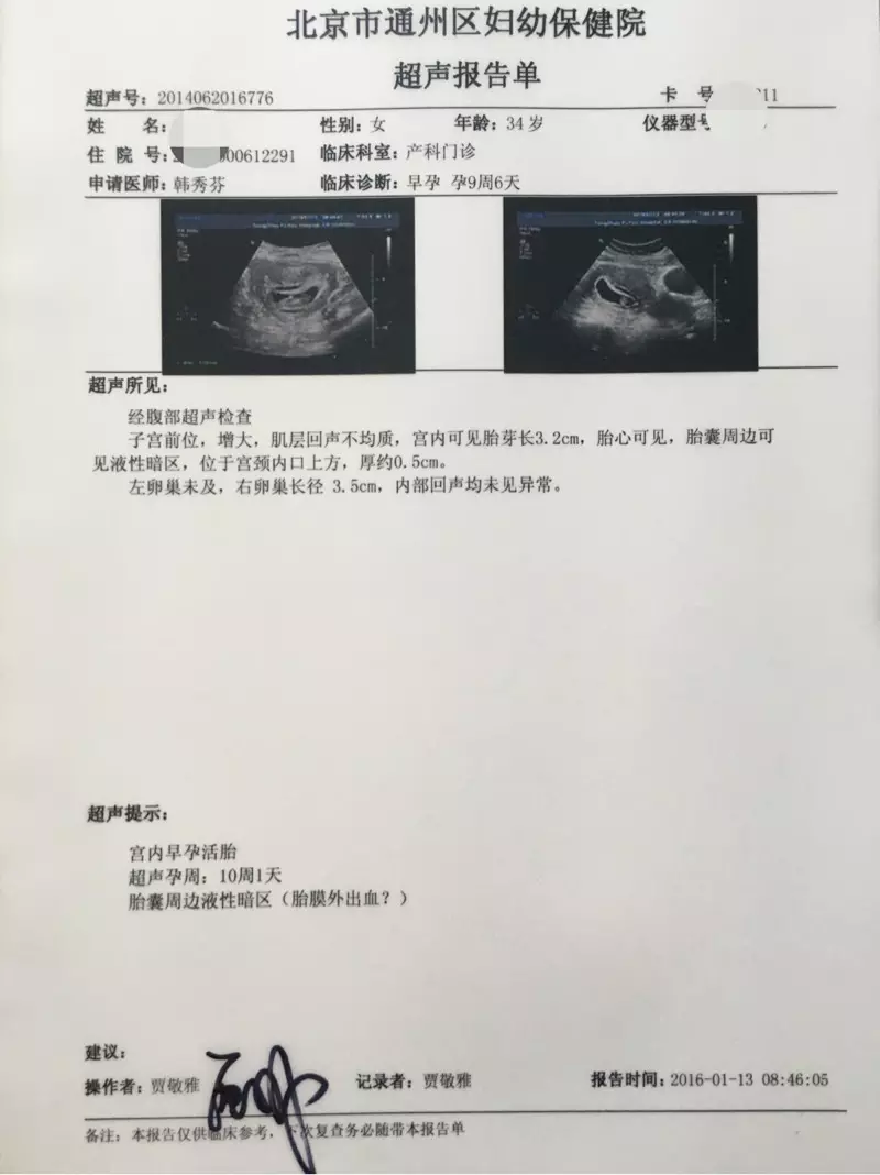 2、怀孕10几天能打掉吗:青岛怀孕10几天能打掉吗？