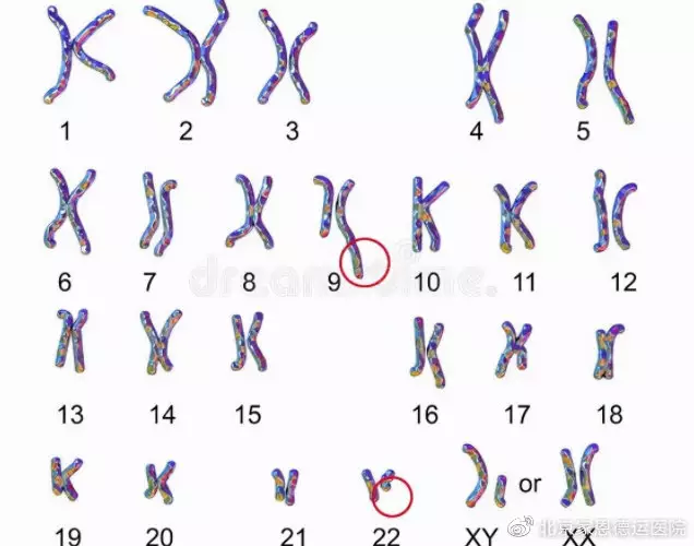 5、怀孕45天抽血查多少钱:微阵列检查多少钱