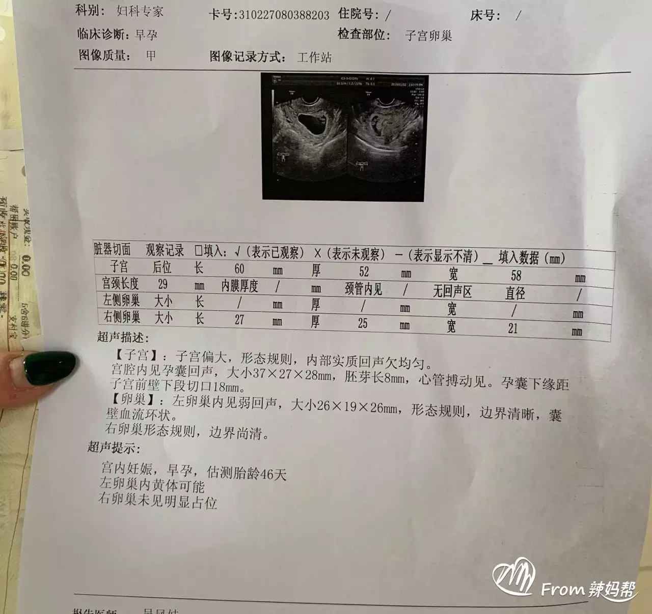 1、查几月份怀孕是男是女表:请问生男生女是命中注定吗？