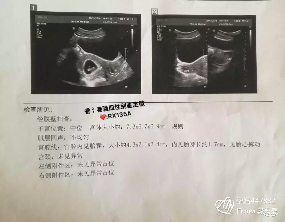 2、如何备孕成功率高:怎样做生男孩的几率大？在备孕的期间有什么要注意的呢？