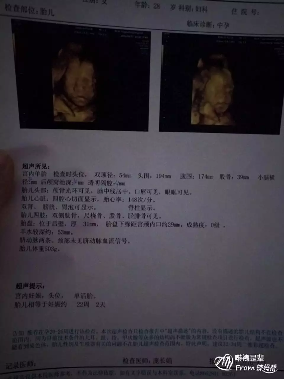 2、男朋友我们订婚了现在我问他怀孕了怎么办 他直接说怀孕了就生 还问我喜欢儿子还是女儿 他是不是认真的