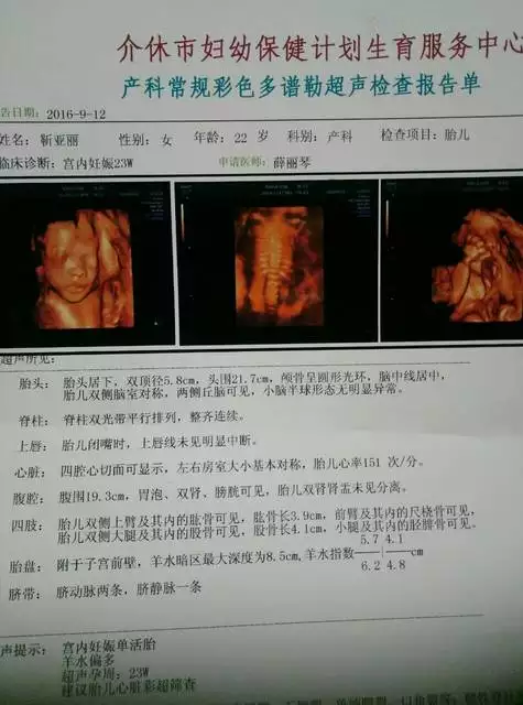 3、您好！三个多月去两个不同地方做b超两次都说是男孩准吗？几率多大