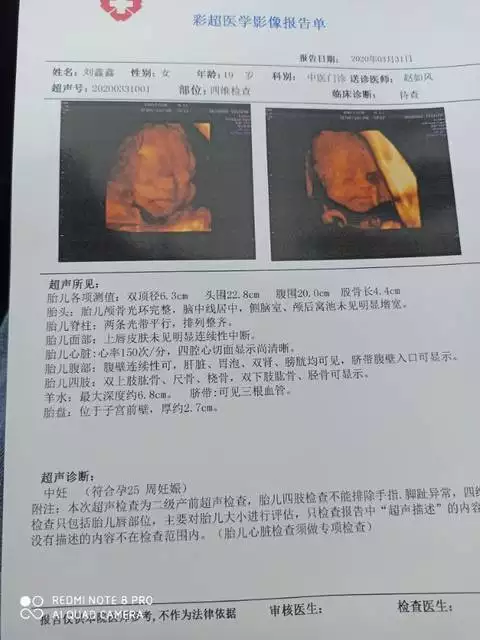 7、已生女孩四维彩超图片:怎么从四维检查单看出是男孩还是女孩