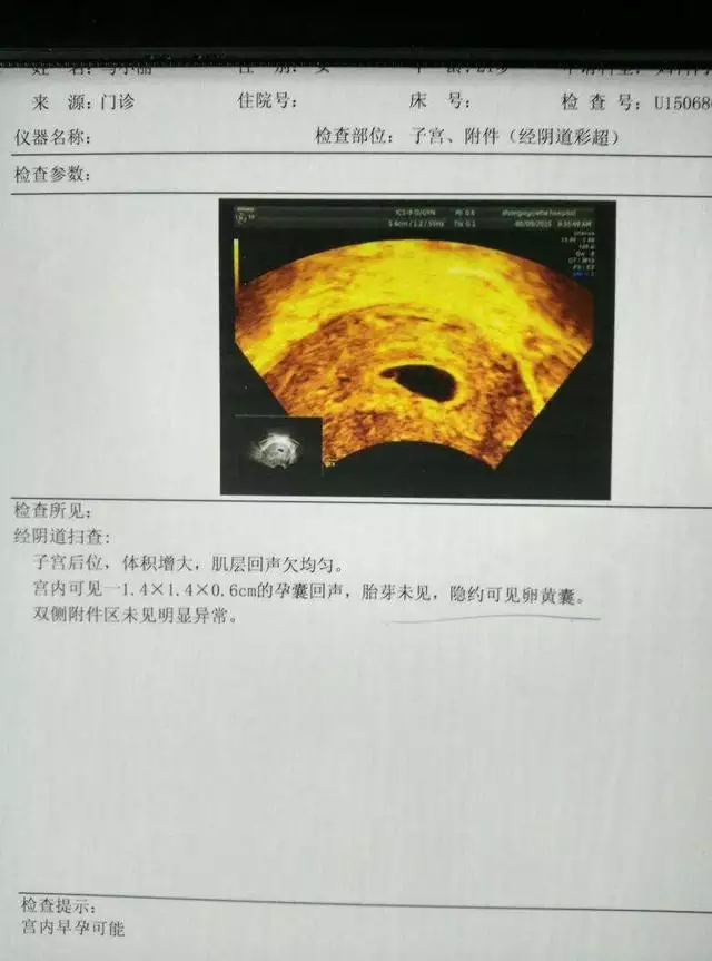 3、怀男孩跟怀女孩的财运:怀儿子带来好运多还是怀女儿带来带