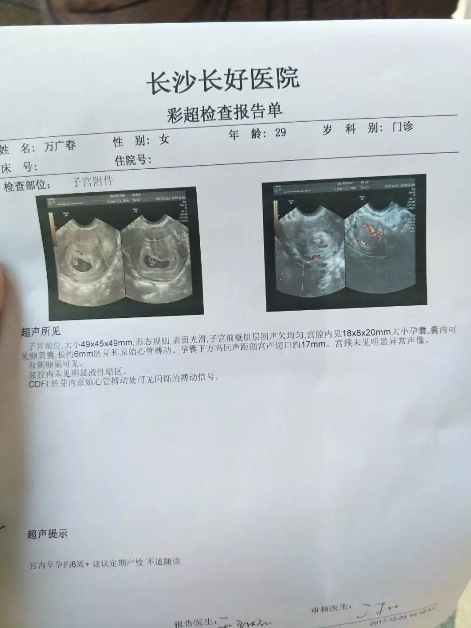 2、怀孕46天了孕囊能看出是男孩女孩吗 宝宝知道