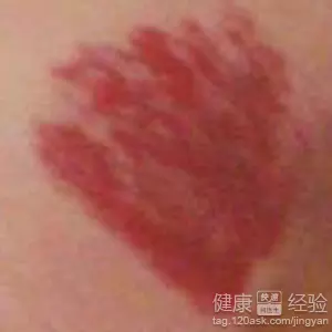 1、身上有胎记的表什么意思:人出生时身上有胎记，这有什么寓意么！过路高人指点下