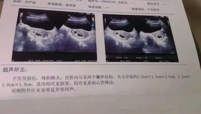 3、该不该离婚测试有孩子:怎么测试该不该离婚吗？