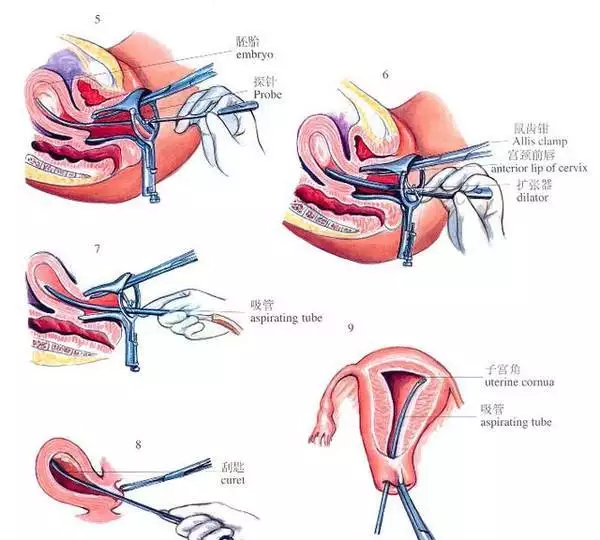 6、打掉的孩子还能吗:我想重新，投个好胎。。如何才能投个好胎。进！！