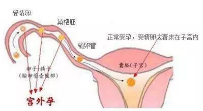 1、什么时间容易怀孕:女性在什么时候最易，什么时候不容易？