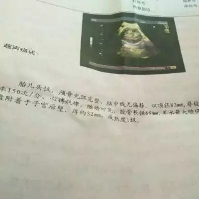 2、九月初预产期的孕妇该怎样准备分娩所需的物品？有什么好的建议和应该注意什么问题吗？