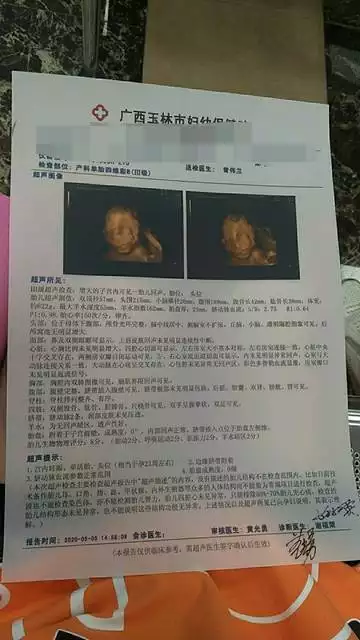 2、怀孕做完四维下次做什么检查:做四维彩超要吃饭去不，做完还要做别的检查吗