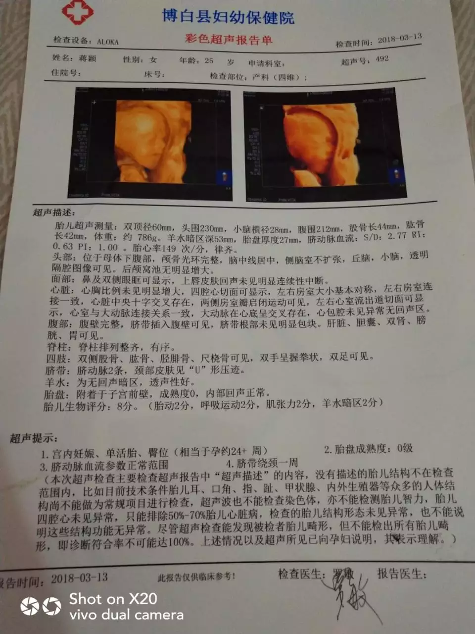 3、怀孕做完四维下次做什么检查:做四维彩超的时候还需要做什么检查