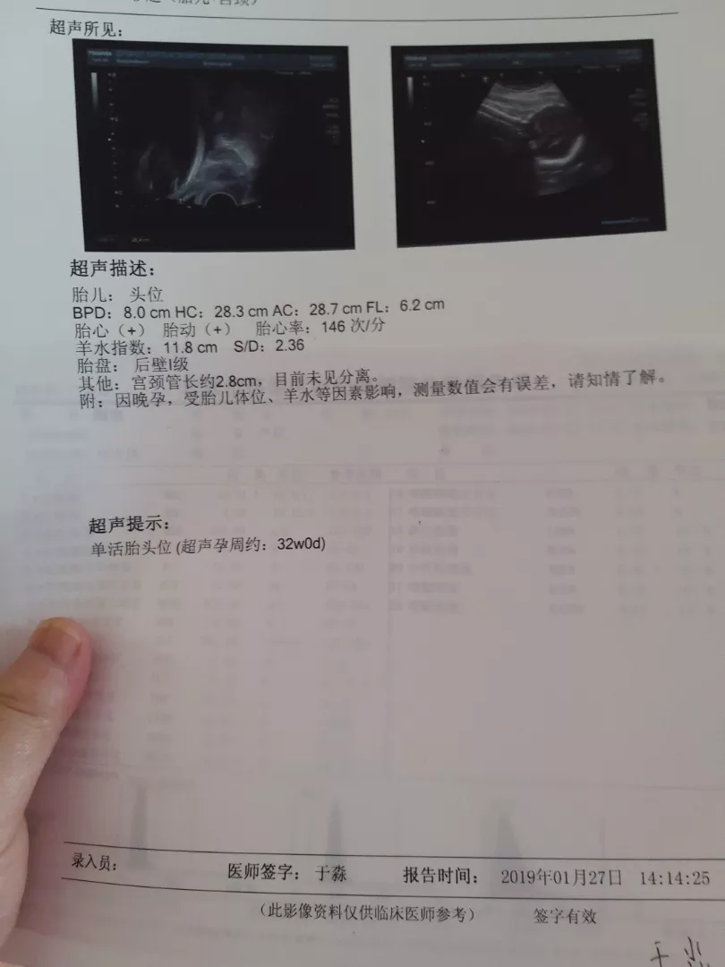 3、预产期是什么时候怀孕的:怀儿子的特征最准的