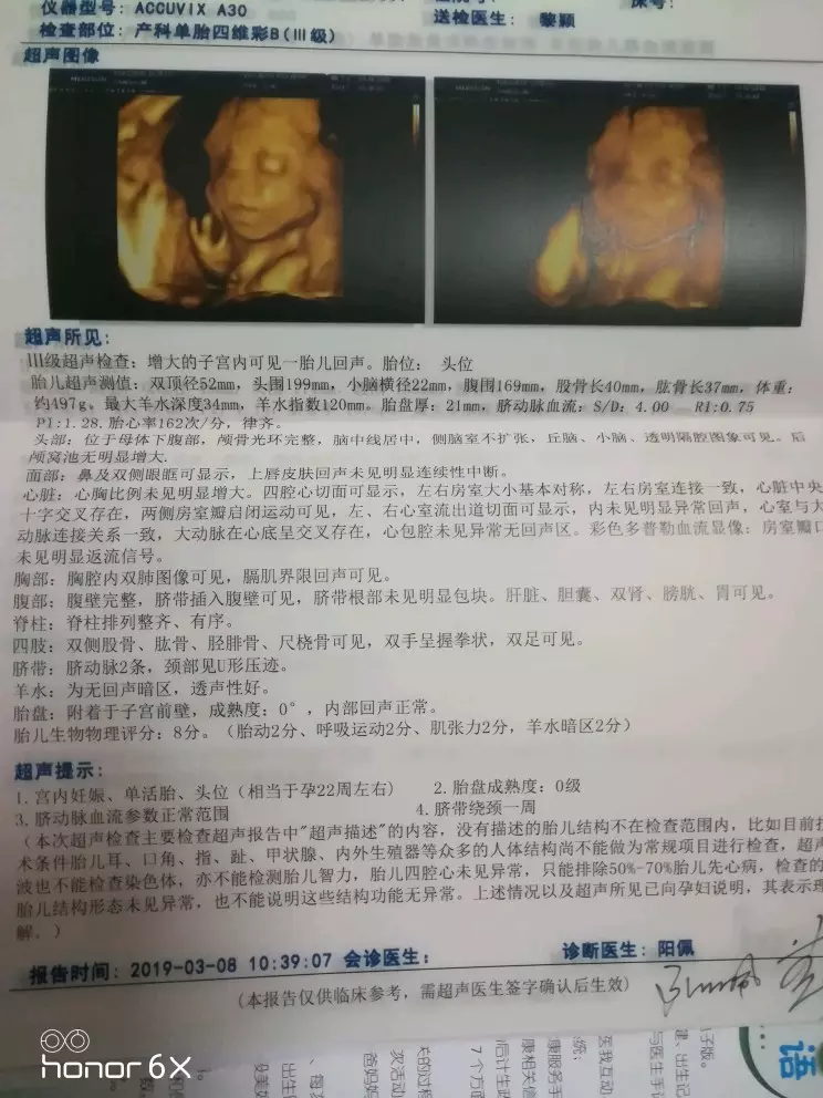 3、生女孩的四维彩超单子图片:怎么从四维检查单看出是男孩还是女孩