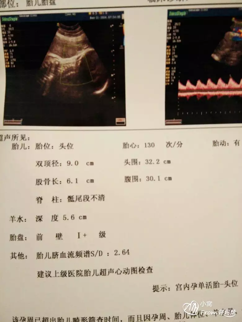 4、我是1月10号来的月经，后来怀孕了，我的预产期应该是哪天？