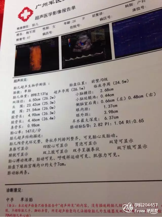 7、四维qualhigh1和2区别:四维qual mid2什么意思