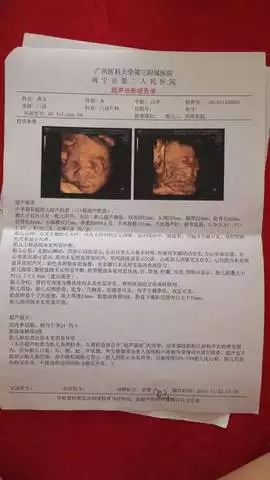 3、怀孕如何判断男女宝宝:孕期如何判断男女？