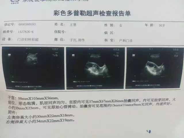 4、怀孕初期怎么知道是儿子还是女儿:清宫表生男生女图计算方法