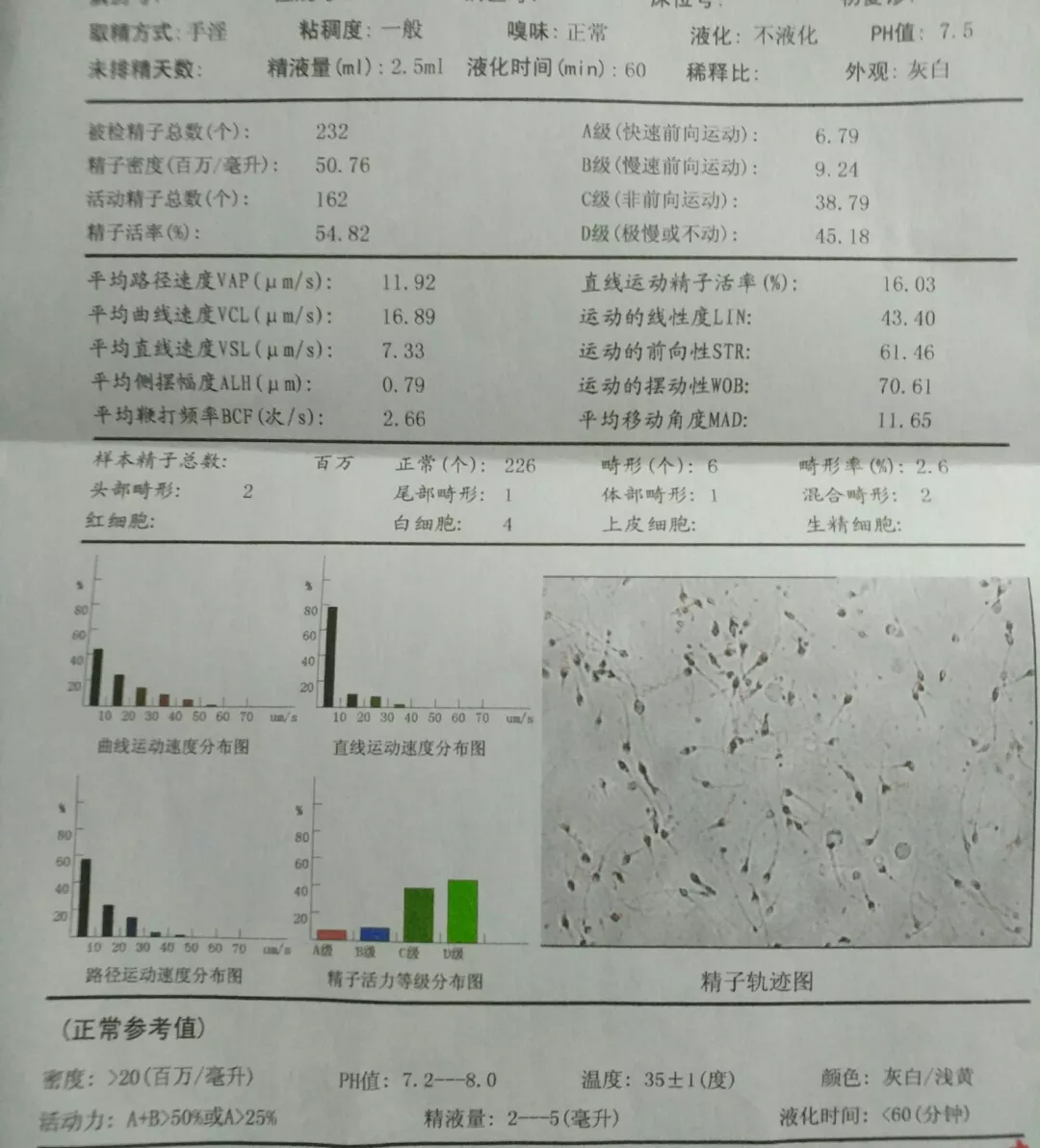 1、如何自我检查质量:男生怎么检测质量