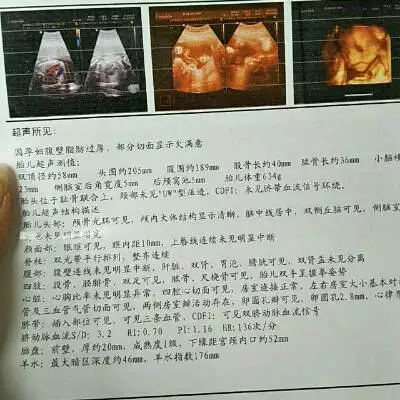 2、怀宝四维单子图片:四维彩超怎么分辨男女图片