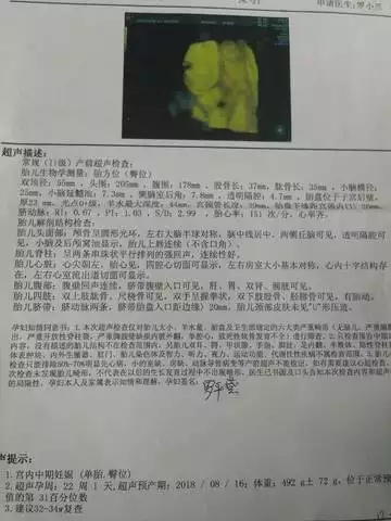 4、怀宝四维单子图片:谁会看四维彩超图片辨别男女