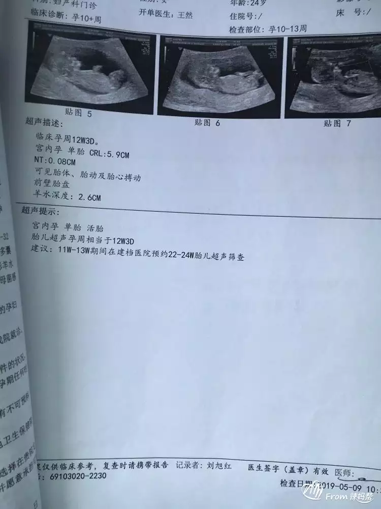 1、命中有几个孩子查询表头胎女:我要看命里有几个孩子