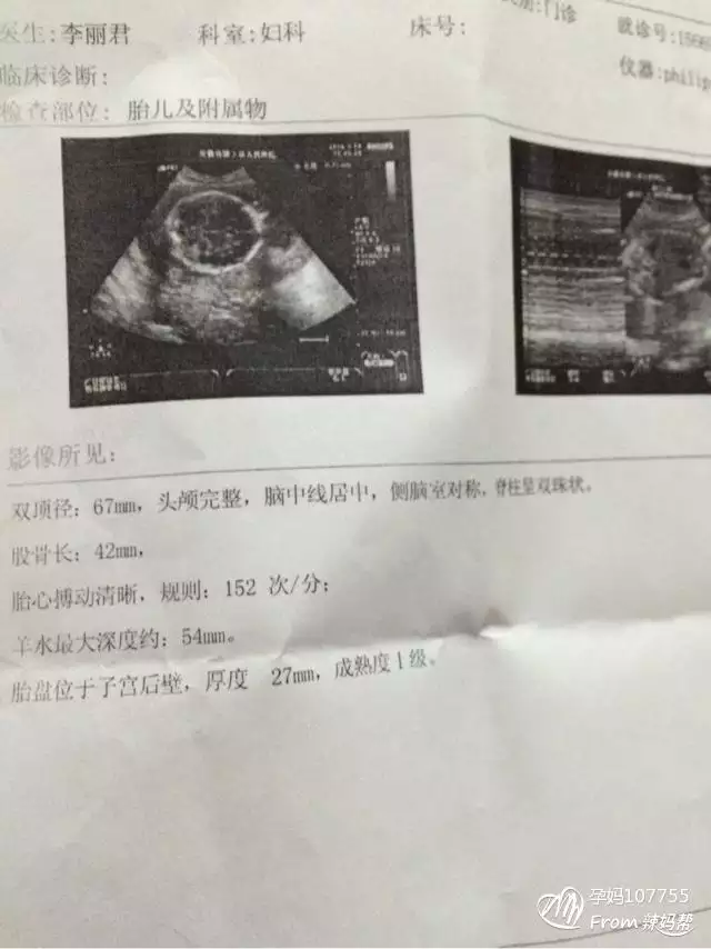 3、命中有几个孩子查询表头胎女:如何测算命中有几个子女