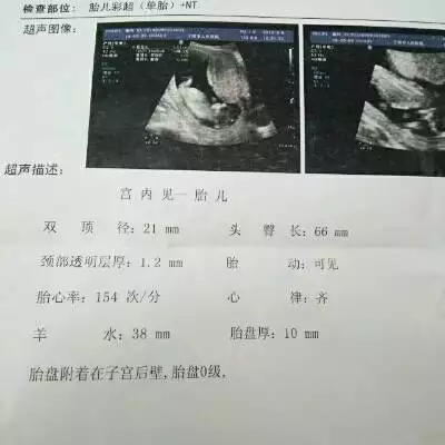 9、命中有几个孩子查询表头胎女:命中有几个孩子查询表