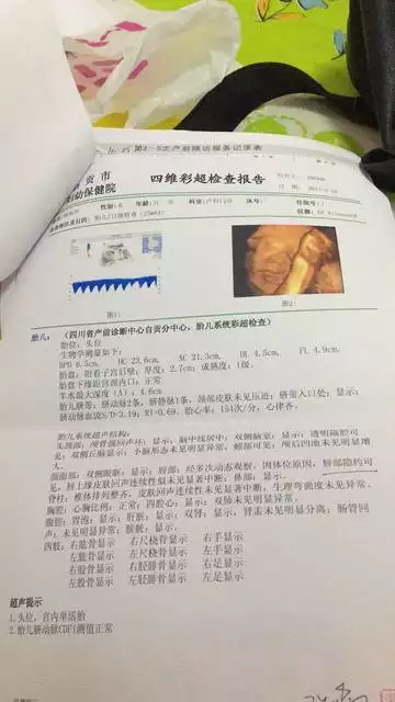 4、怀男孩的四维彩超图片:我们刚做完四维彩超！这是男孩吗？谢谢大家！