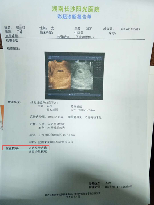 1、怀孕小子和闺女有什么症状:生女孩是什么症状