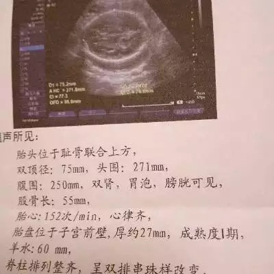 2、怀孕怎么判断男女:如何通过孕期症状判断男女？