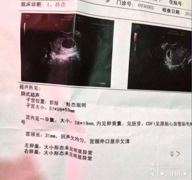 1、怀孕怎么分辨男女最准:怀孕怎么算男女最准确的